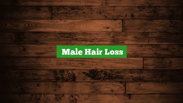 ﻿male Hair Loss 